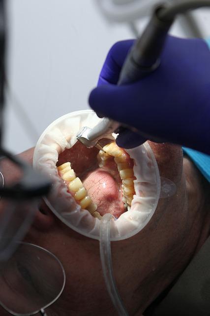 Jaké jsou nejlepší služby bělení zubů v Olomouci?