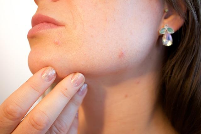 Doporučení od dermatologa pro péči o povislou kůži na stehnech